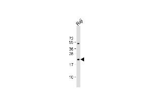 Anti-VHL Antibody (C-term) at 1:1000 dilution + Raji whole cell lysate Lysates/proteins at 20 μg per lane. (VHL 抗体  (C-Term))