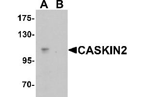 Western blot analysis of CASKIN2 in Hela cell lysate with CASKIN2 antibody at 1 µg/mL in (A) the absence and (B) the presence of blocking peptide. (CASKIN2 抗体  (N-Term))