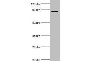 Western blot All lanes: CDH11 antibody at 6 μg/mL + Jurkat whole cell lysate Secondary Goat polyclonal to rabbit IgG at 1/10000 dilution Predicted band size: 88, 77 kDa Observed band size: 88 kDa (OB Cadherin 抗体  (AA 637-796))