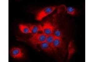 Immunofluorescent analysis of BCL2 (pT56) staining in A549 cells. (Bcl-2 抗体  (pSer56))