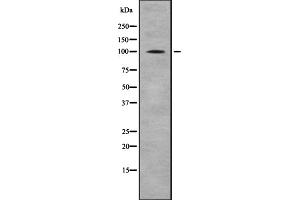 Western blot analysis of CTNNA1/CTNNA2 using HeLa whole cell lysates (CTNNA2 抗体  (C-Term))