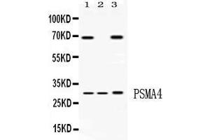 Western blot analysis of PSMA4 expression in rat liver extract ( Lane 1), mouse spleen extract ( Lane 2) and HELA whole cell lysates ( Lane 3).