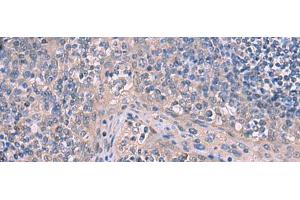 Immunohistochemistry of paraffin-embedded Human tonsil tissue using ITPR2 Polyclonal Antibody at dilution of 1:65(x200) (ITPR2 抗体)