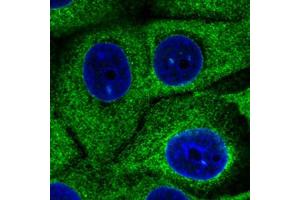 Immunofluorescent staining of MCF7 cells with HSP90B1 monoclonal antibody, clone CL2647  (Green) shows specific endoplasmic reticulum. (GRP94 抗体)