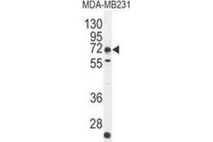 Western blot analysis in MDA-MB231 cell line lysates (35ug/lane) using C18orf8/MIC1 Antibody (N-term). (C18orf8 抗体  (N-Term))