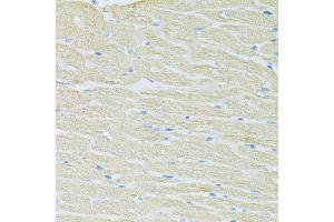 Immunohistochemistry of paraffin-embedded rat heart using SLC40A1 antibody (ABIN6292414) at dilution of 1:100 (40x lens). (SLC40A1 抗体)