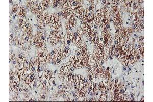 Immunohistochemical staining of paraffin-embedded Human liver tissue using anti-EXOSC7 mouse monoclonal antibody. (EXOSC7 抗体)