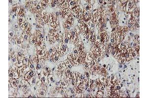 Immunohistochemical staining of paraffin-embedded Human liver tissue using anti-EXOSC7 mouse monoclonal antibody. (EXOSC7 抗体)
