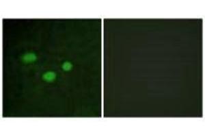Immunofluorescence analysis of HeLa cells, using DNMT3B antibody. (DNMT3B 抗体  (N-Term))