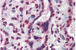 Human Placenta (formalin-fixed, paraffin-embedded) stained with ATF6 antibody ABIN337286 at 10 ug/ml followed by biotinylated anti-mouse IgG secondary antibody ABIN481714, alkaline phosphatase-streptavidin and chromogen. (ATF6 抗体  (AA 1-273))