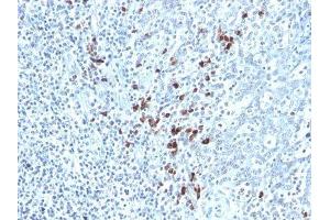 Image no. 1 for Mouse anti-Human kappa Light Chain antibody (ABIN6174069) (小鼠 anti-人 kappa Light Chain Antibody)