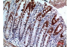 Immunohistochemistry (IHC) analysis of paraffin-embedded Human Colon, antibody was diluted at 1:100.