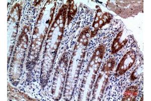 Immunohistochemistry (IHC) analysis of paraffin-embedded Human Colon, antibody was diluted at 1:100. (IL1R2 抗体  (Internal Region))