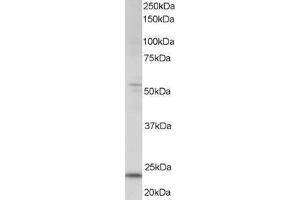 Image no. 1 for anti-MAX Dimerization Protein 4 (MXD4) (AA 212-224) antibody (ABIN297414)