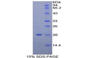 SDS-PAGE analysis of Human Cyclophilin B Protein. (PPIB 蛋白)