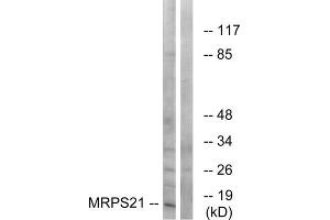 Western blot analysis of extracts from COS cells, using MRPS21 antibody. (MRPS21 抗体  (Internal Region))