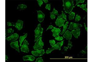 Immunofluorescence of monoclonal antibody to ROCK1 on HeLa cell. (ROCK1 抗体  (AA 401-510))