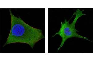 Figure3: Confocal immunofluorescence analysis of Hela (left) and 3T3-L1 (right) cells using WNT1 mouse mAb (green). (WNT1 抗体)