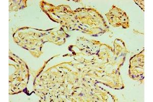 Immunohistochemistry of paraffin-embedded human placenta tissue using ABIN7164787 at dilution of 1:100 (P4HA3 抗体  (AA 20-544))