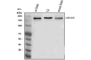 Western blot analysis of NMDAR2B using anti-NMDAR2B antibody (ABIN3042432).