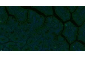 Paraformaldehyde-fixed, paraffin embedded Mouse small intestine, Antigen retrieval by boiling in sodium citrate buffer (pH6. (CD248 抗体  (AA 251-350))