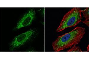 ICC/IF Image Pyruvate Dehydrogenase E1 alpha antibody detects Pyruvate Dehydrogenase E1 alpha protein at mitochondria by immunofluorescent analysis. (Pyruvate Dehydrogenase E1 alpha (Center) 抗体)