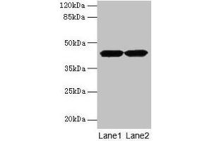 Western blot All lanes: ACTRT2 antibody at 6 μg/mL Lane 1: HepG2 whole cell lysate Lane 2: A431 whole cell lysate Secondary Goat polyclonal to rabbit IgG at 1/10000 dilution Predicted band size: 42 kDa Observed band size: 42 kDa (ACTRT2 抗体  (AA 1-376))