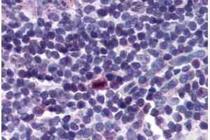 Human Tonsil (formalin-fixed, paraffin-embedded) stained with BIRC5 antibody ABIN214295 at 2. (Survivin 抗体  (C-Term))