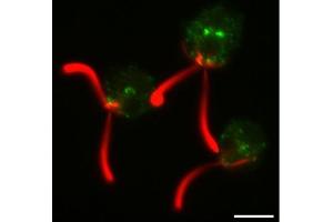 Immunofluorescence (IF) image for anti-Clathrin Heavy Chain (CLTC) antibody (ABIN7477856) (Clathrin Heavy Chain (CLTC) 抗体)