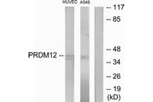 Western blot analysis of extracts from HuvEc/A549 cells, using PRDM12 Antibody. (PRDM12 抗体  (AA 191-240))