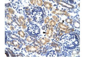 P2RX7 antibody was used for immunohistochemistry at a concentration of 4-8 ug/ml to stain Epithelial cells of renal tubule (arrows) in Human Kidney. (P2RX7 抗体  (N-Term))