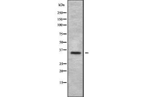 Western blot analysis OR6B1 using HepG2 whole cell lysates. (OR6B1 抗体)