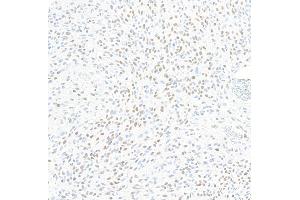 Immunohistochemistry (IHC) image for anti-Zinc Finger E-Box Binding Homeobox 1 (ZEB1) (AA 750-800) antibody (ABIN7455173) (Recombinant ZEB1 抗体  (AA 750-800))