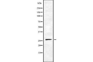 Western blot analysis of TAF9B using NIH-3T3 whole cell lysates (TAF9B 抗体  (N-Term))