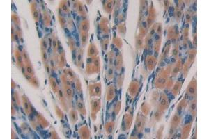 DAB staining on IHC-P; Samples: Mouse Stomach Tissue