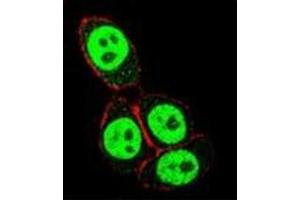 Confocal immunofluorescent analysis of SMAD3 Antibody  with Hela cell followed by Alexa Fluor 488-conjugated goat anti-rabbit lgG (green). (SMAD3 抗体  (Ser208))