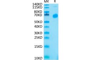 SDS-PAGE (SDS) image for CD70 Molecule (CD70) (AA 50-193), (Trimer) protein (His tag) (ABIN7274322)