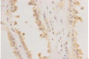 Immunohistochemistry (Paraffin-embedded Sections) (IHC (p)) image for anti-RAS (RAD and GEM)-Like GTP Binding 2 (REM2) (C-Term) antibody (ABIN1854972) (REM2 抗体  (C-Term))