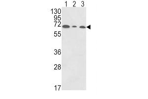 Western Blotting (WB) image for anti-Polymeric Immunoglobulin Receptor (PIGR) antibody (ABIN3003801) (PIGR 抗体)