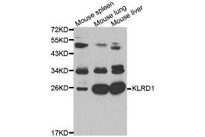 Western Blotting (WB) image for anti-Killer Cell Lectin-Like Receptor Subfamily D, Member 1 (KLRD1) (AA 32-179) antibody (ABIN3022763)