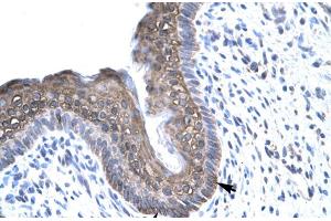 Immunohistochemistry (IHC) image for anti-Forkhead Box E3 (FOXE3) (C-Term) antibody (ABIN2779556)