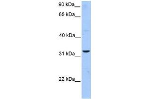 ATG5 antibody used at 1 ug/ml to detect target protein. (ATG5 抗体)