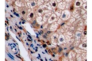 Detection of Ki-67 in Human Liver Tissue using Polyclonal Antibody to Ki-67 Protein (Ki-67) (Ki-67 抗体  (AA 3088-3235))
