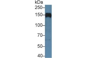 Western blot analysis of Human Raji cell lysate, using Human CR2 Antibody (5 µg/ml) and HRP-conjugated Goat Anti-Rabbit antibody ( (CD21 抗体  (AA 729-957))
