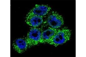 Immunofluorescence (IF) image for anti-Transient Receptor Potential Cation Channel, Subfamily M, Member 8 (TRPM8) (AA 263-292) antibody (ABIN3029242)