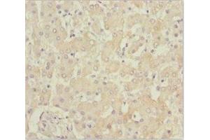 Immunohistochemistry of paraffin-embedded human liver tissue using ABIN7145187 at dilution of 1:100 (B9D1 抗体  (AA 1-130))