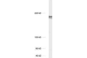dilution: 1 : 1000, sample: unboiled rat hippocampus homogenate (TNIK 抗体)