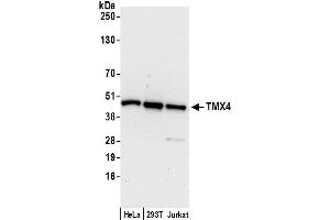 anti-Thioredoxin-Related Transmembrane Protein 4 (TMX4) (AA 299-349) antibody