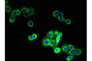 Immunofluorescent analysis of A431 cells using ABIN7159501 at dilution of 1:100 and Alexa Fluor 488-congugated AffiniPure Goat Anti-Rabbit IgG(H+L) (STEAP1 抗体  (AA 3-69))