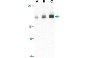 Western blot analysis of PTRH2 in Daudi cell lysate with PTRH2 polyclonal antibody  at (A) 1, (B) 2, and (C) 4 ug/mL . (PTRH2 抗体  (Internal Region))